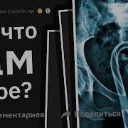 Врачи Рассказывают О Худших Травмах Из За Ceк 2