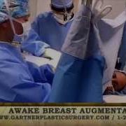 Watch Patient Talk During Awake Breast Augmentation Surgery