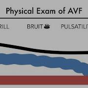 Avf