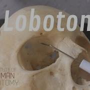 Lobotomy