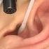 ASMR Ear Cleaning Satisying Earwax Removal Experience