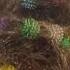 6 Year Old Gets 150 Bunchems Velcro Balls Stuck In Her Hair