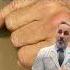 Don T Ignore A Finger Fracture Dr Badia Explains Why You Should See A Specialist