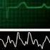 Кардиомонитор Пульс Ритма сердечного слежение
