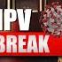 New Virus Alert China In Lockdown What Is HMPV Virus Symptoms Of HMPV Virus China New Virus