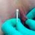 The Q Tip Test For VCH Vertical Hood Piercing Suitability