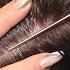 ASMR Intense Scalp SCRATCHING And NITPICKING With Nails Real Person