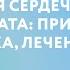 Дисфункция сердечного трансплантата причины диагностика лечение