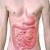 INTESTINES In SPANISH Excel In Medical Consecutive Interpretation