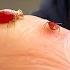 Bed Bugs What You Ve Been Told Is Totally False