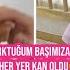 YAŞADIĞIMIZ KORKUNÇ KAZA HER YER KAN OLDU DİKİŞ GEREKEBİLİR BAYGINLIK GEÇİRİYORDUM