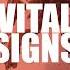 Shorts Mind Electric Vital Signs OUT NOW