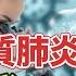 新病毒 人類間質肺炎 大爆發 醫院人滿為患 2025 1 4 健康1 1 直播