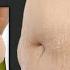 BURN HANGING LOWER BELLY FAT GET RESULTS IN JUST 2 WEEKS