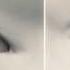 How Double Eyelid Surgery Works