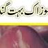 Sozak Ka Mukamal Ilaj Sozak Kia Hai Gonorrhea Treatment In Urdu Hindi Hakeem Shan Ali سوزا ک