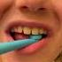 Your Kids Don T Like Brushing Their Teeth WATCH THIS Brushing Teeth Song Shorts