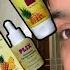 How I Got Rid Of Pigmentations And Dark Spots By Using Plix Pineapple Facewash Serum