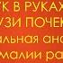 Ультразвук в руках уролога УЗИ почек Нормальная анатомия и аномалии развития