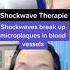 Shockwave Therapy For Erectile Dysfunction ED Gainswave Shorts