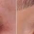 WOW How To Remove Eye Redness In Minutes Shonagh Scott