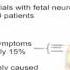 WSCS16 Day 3 Neurological Disease And Stroke