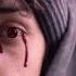 Realistic Mangekyou Sharingan In Real Life Amaterasu Naruto Itachi Sasuke Shorts Anime Edit