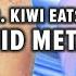 Emergency FruitSurgery Mr Kiwi Swallows Liquid Metal DiscountDentist Ep 144 Shorts