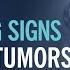 6 Warning Signs Of Brain Tumors