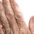 2 Fast Remedies For Dry And Wrinkled Hands THAT WORK