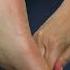 Can Foot Massage Help Sciatica