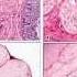 BST Soft Tissue Pathology101 Normal Soft Tissue Histology Vascular And Peripheral Nerve Lesions