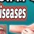 Common Disease Common Disease In Humans Common Disease And Medicines