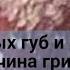 Зуд половых губ и влагалища причина грибок Лечение