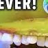 Emergency FruitSurgery EVERY DENTIST EVER DiscountDentist Ep 121 Shorts