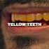 Zuniga On Why You STILL Have Yellow Teeth