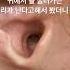 고막을 덮은 마른 귀지 귀지 귀지제거 마른귀지 귀파기 귓밥 耳掃除 Earwax 귀청소 왕귀지 Earcleaning