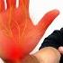 FIX Carpal Tunnel Stretches And Exercises For Carpal Tunnel Symptoms