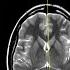 How To Read An MRI Of The Brain First Look MRI