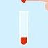 What Is Normal Fasting Blood Sugar Levels On Intermittent Fasting Dr Berg