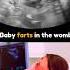 Funny Baby Farts In The Womb Mom Surprised Just For Fun Babies Don T Fart