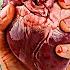 What Happens If We Defibrillate A Real Heart