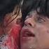 Sharukh Khan Dying Baazigar