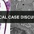 2024 11 19 Nephropathology Clinical Case Discussion Rounds