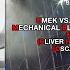 UMEK Mechanical Blade Vs Where S Your Head At Oliver Heldens Mashup OscarL Remake