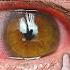 6 Top Causes Of IRRITATED EYES Tips For Relief