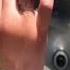 مش هتصدق عملوا ايه عند إزالة الخاتم العالق في الإصبع UNBELIEVABLE RING STUCK ON FINGER Shorts