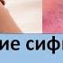 Заражение сифилисом и гонореей после анального секса