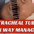 Endotracheal Tube Intubation Step By Tep Ett Airwaymanagement Anesthesia Genreal Laryngoscope