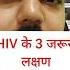 Hiv Positive क 3 लक षण Hivsymptoms Aidssymptoms Hivpositivelaksn Aidslaksn Hivilaj Aidsilaj